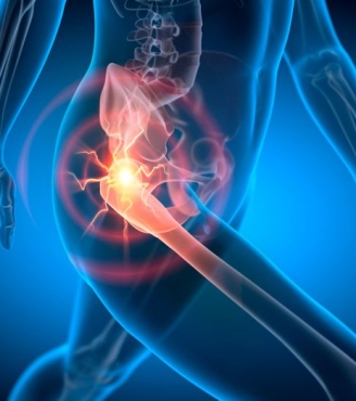 Οσφυική ριζίτιδα