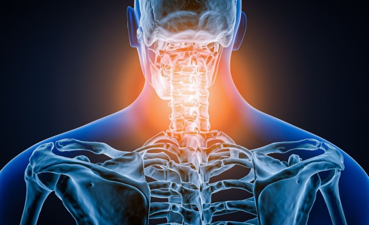 Σύνδρομο αυχενικών αρθρώσεων