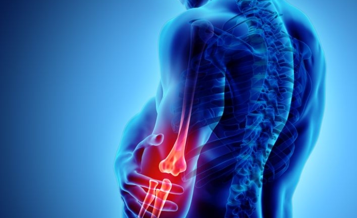 Επικονδυλίτιδα