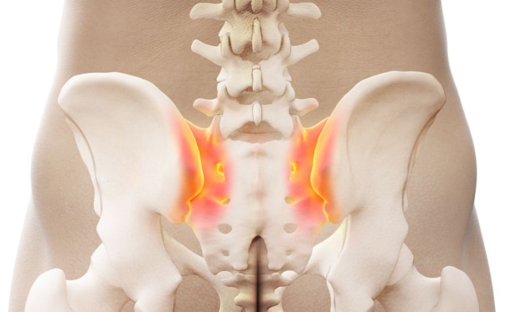 Πόνος ιερολαγόνιου άρθρωσης