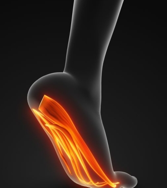 Πελματιαία απονευρωσίτιδα