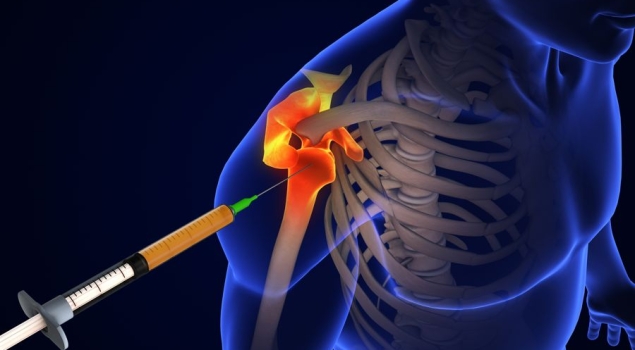 Τεχνική hydrodissection