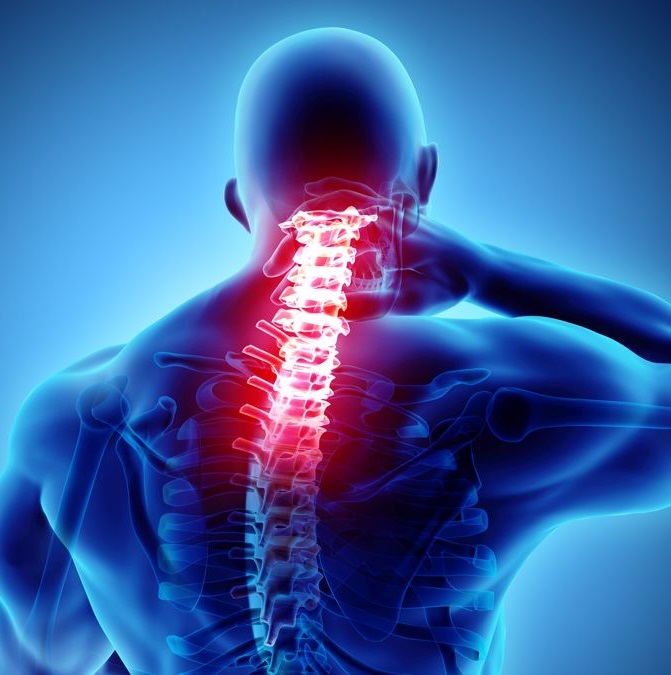 Neck pain