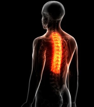 Σύνδρομο ζυγοαποφυσιακών αρθρώσεων